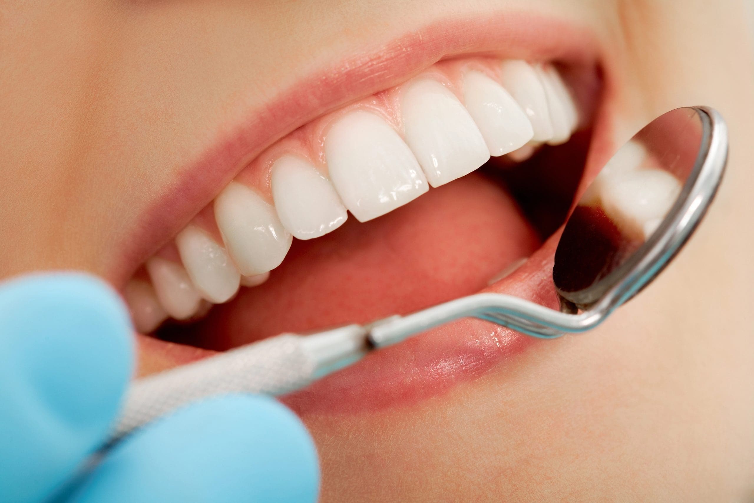 The Importance of Mouth Care: Simple Steps for a Healthier Smile