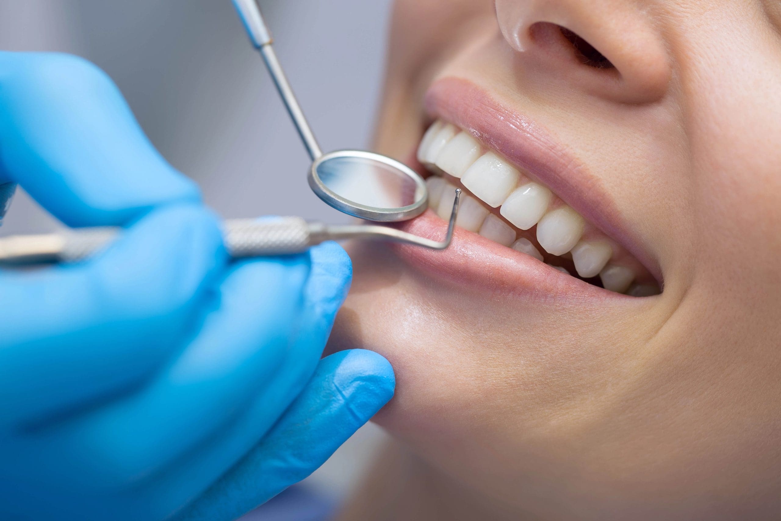 Dental Implants vs Veneers: A Comparison Guide